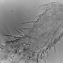 Chaetonotus (Primochaetus) rectaculeatus