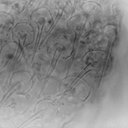Chaetonotus (Primochaetus) rectaculeatus