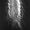 Chaetonotus furcatus