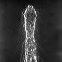 Chaetonotus paucisquamatus