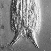 Collection scientifique : Gastrotricha - Chaetonotida : Xenotrichulidae