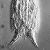 Kolekcja naukowa: Gastrotricha - Chaetonotida: Xenotrichulidae