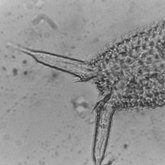 Scientific collection: Gastrotricha - Chaetonotida: Xenotrichulidae