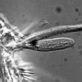 Collection scientifique : Gastrotricha - Macrodasyida : Thaumastodermatidae